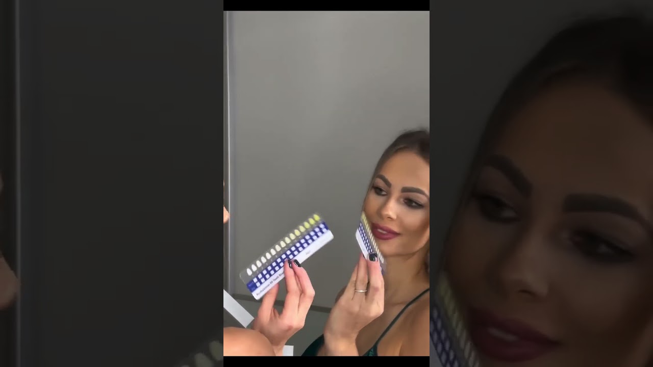 Elitesmile.hu LED-es fogfehérítő