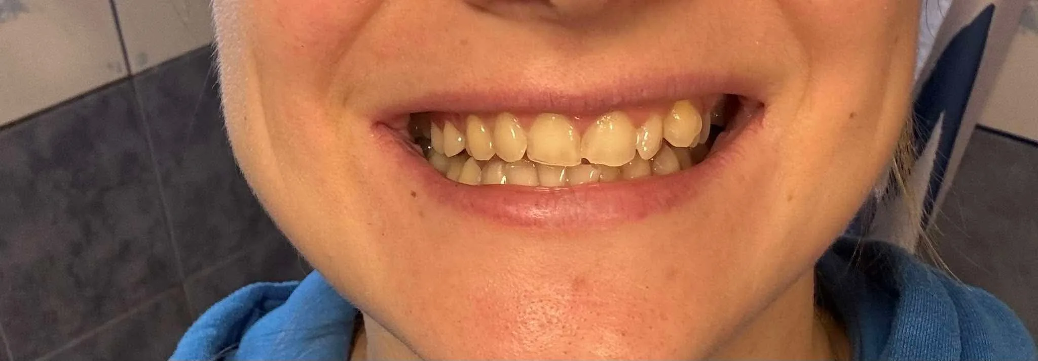 54d2b30b9e87df86aed784a5226a0ed9