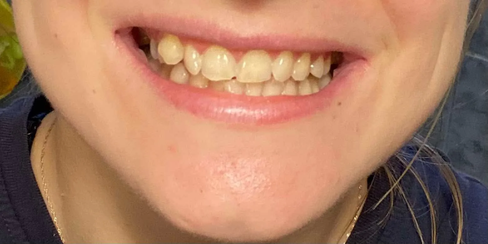 fd6b265d7f5e9c8a7bfb8b9e19fdd293