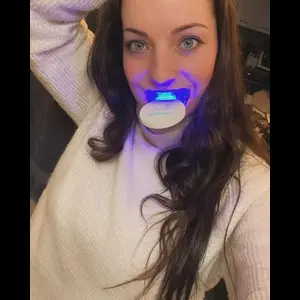 led fogfehérítő használat közben