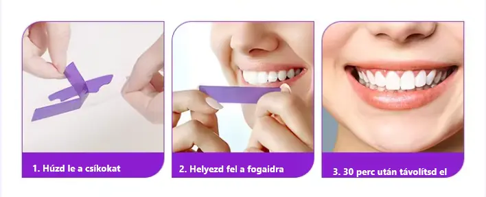 lila-fogfeherito-csik-elitesmile
